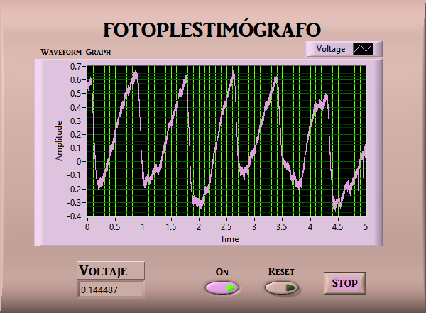 Fotopletismográfo